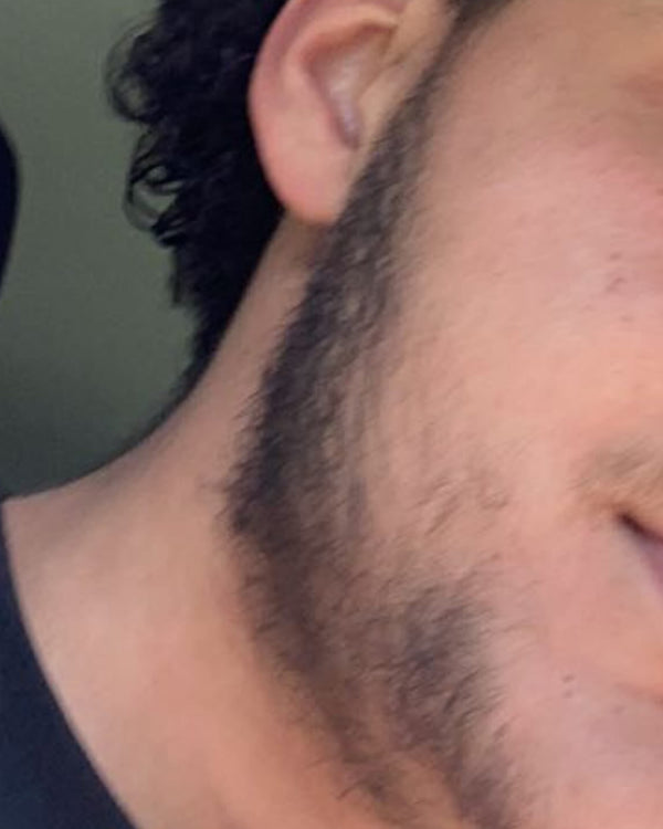 Before photo – Suhaib K.