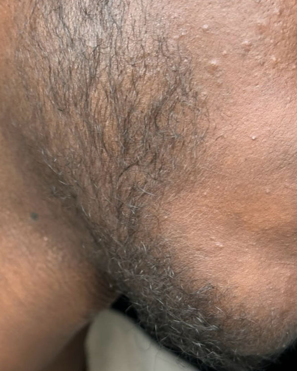 Before photo – Ahmed R.