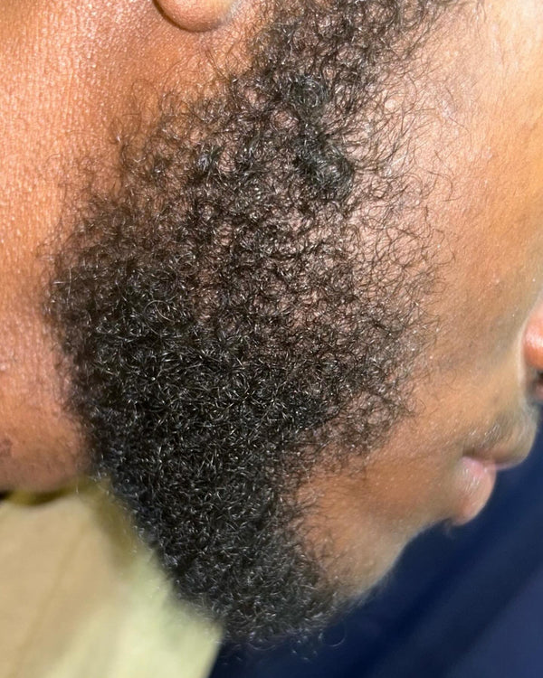 After photo – Ahmed R.