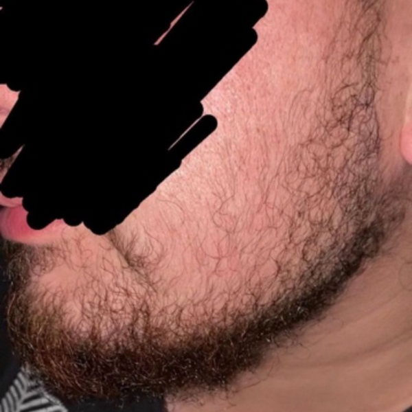 Before photo – Salih A.