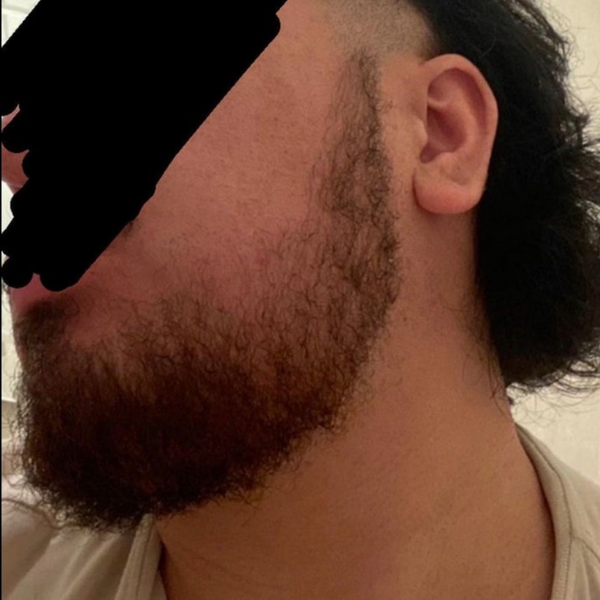 After photo – Salih A.