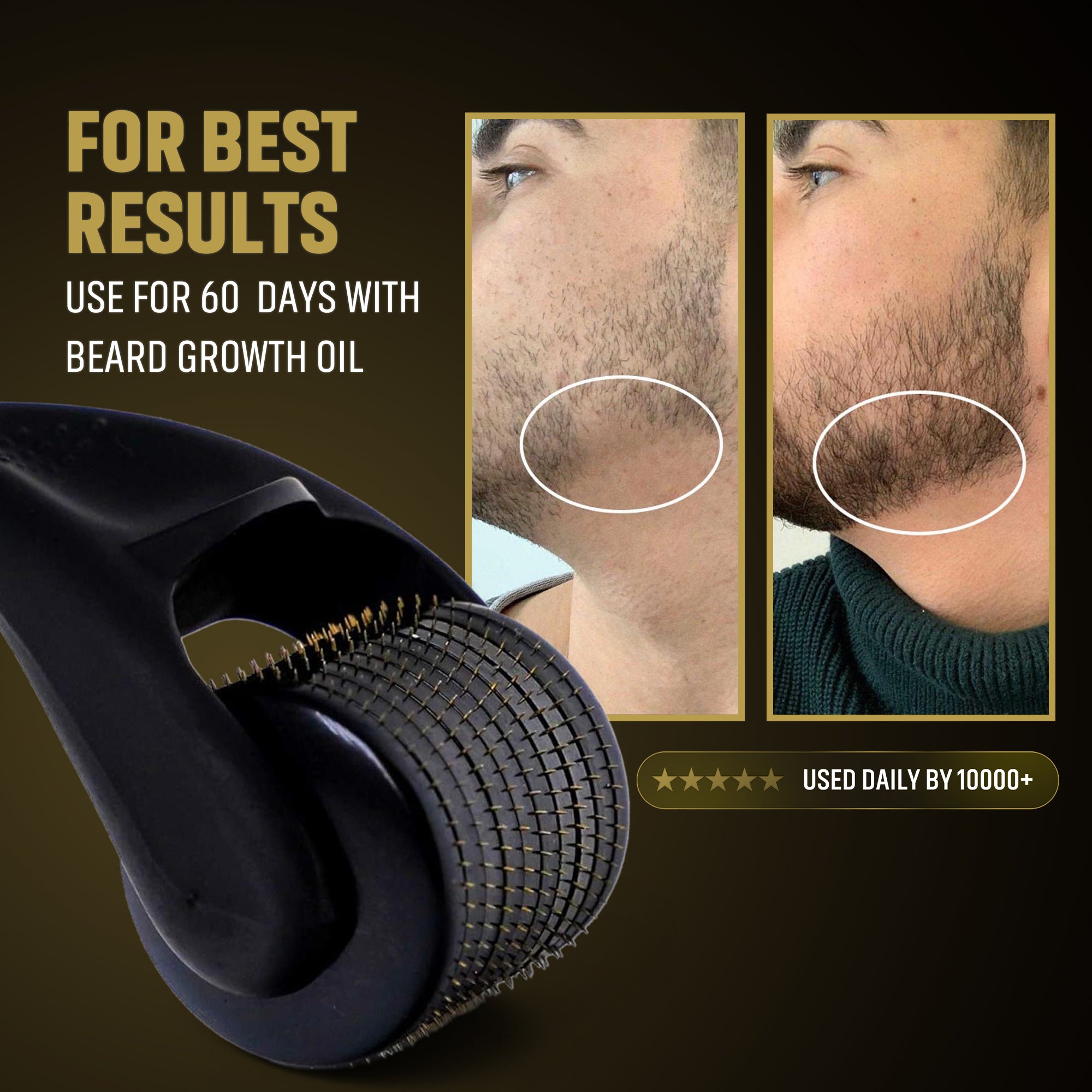 Beard Growth Roller – Activate Beard Growth Fast