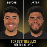Before and after comparison of a man with beard growth, showing a clear improvement over 60 days.